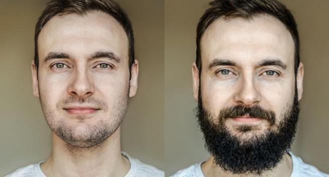 barba plus prima e dopo recensioni